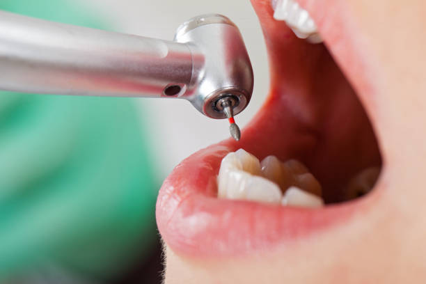 Best Tooth Pain Emergency Relief  in Colby, WI